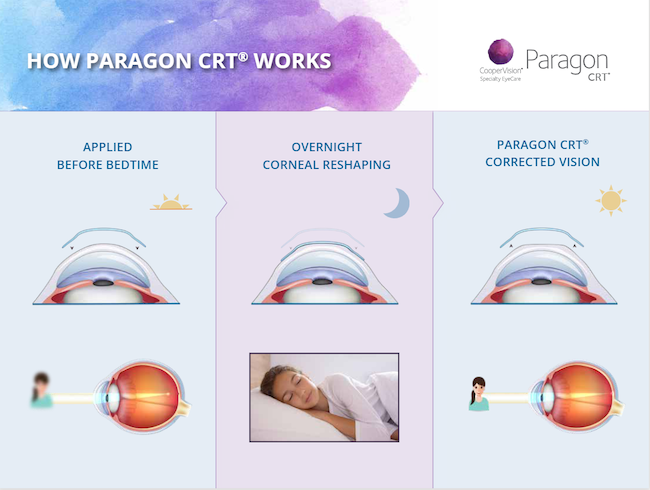 Paragon CRT, how it works graphic