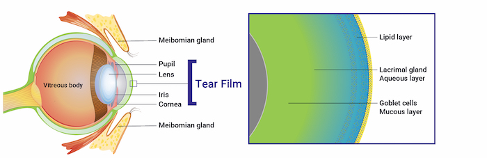 Does Dry Eye Cause Blurry Vision?